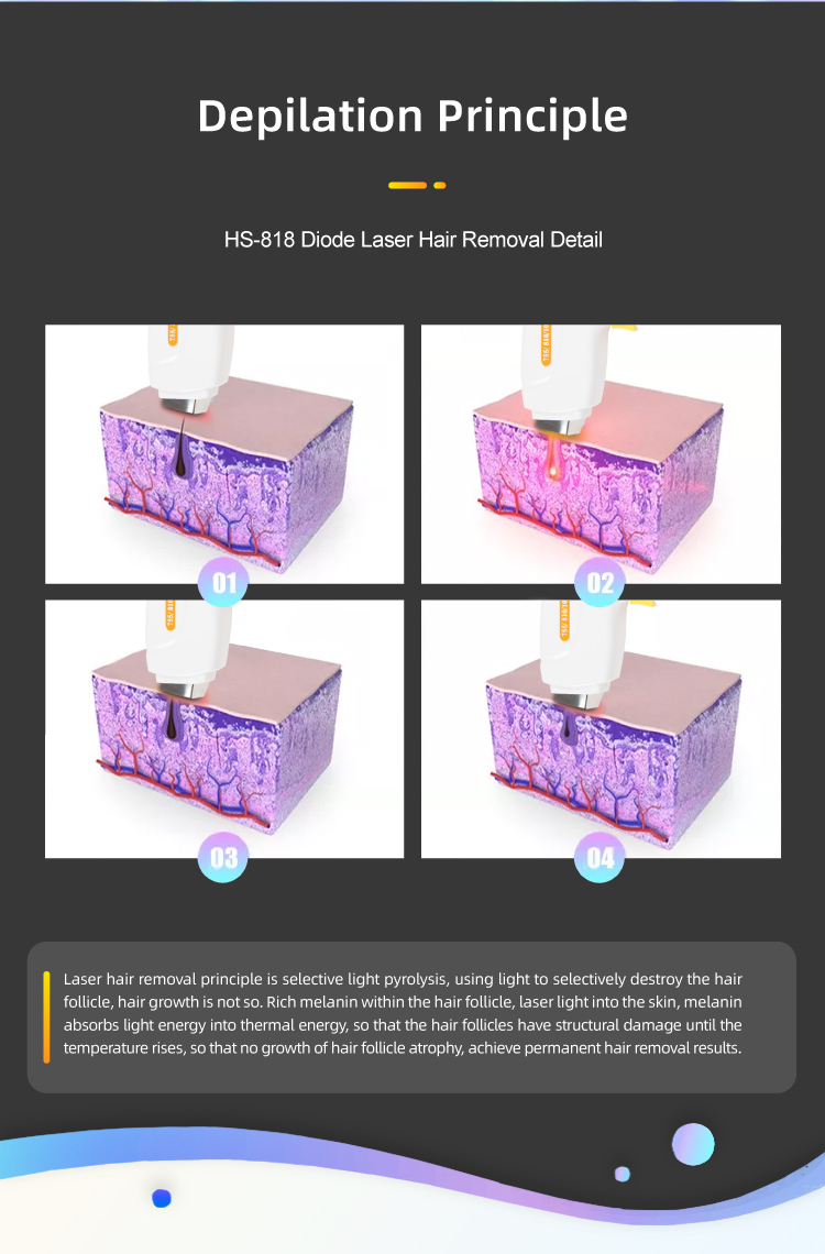 high power diode laser equipment HS-818插图3