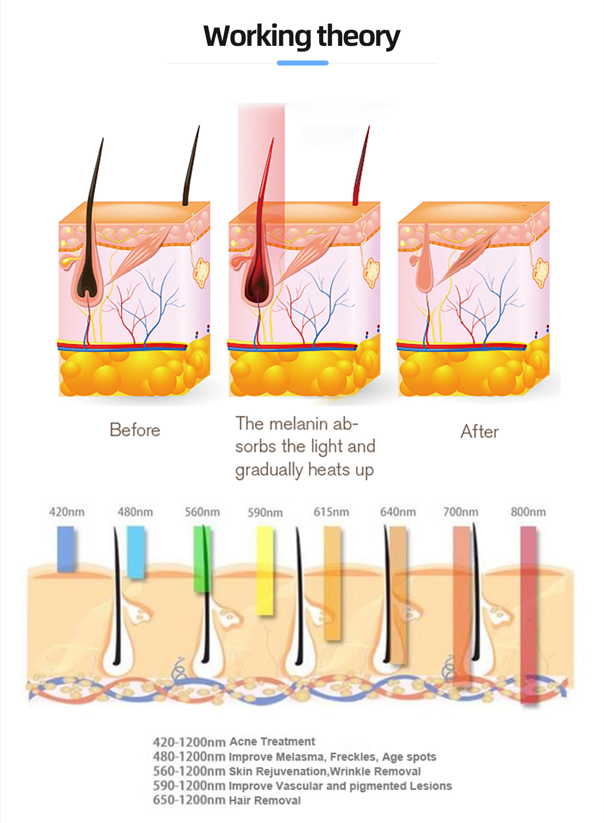 IPL Laser Hair Removal Device HS-300C插图2