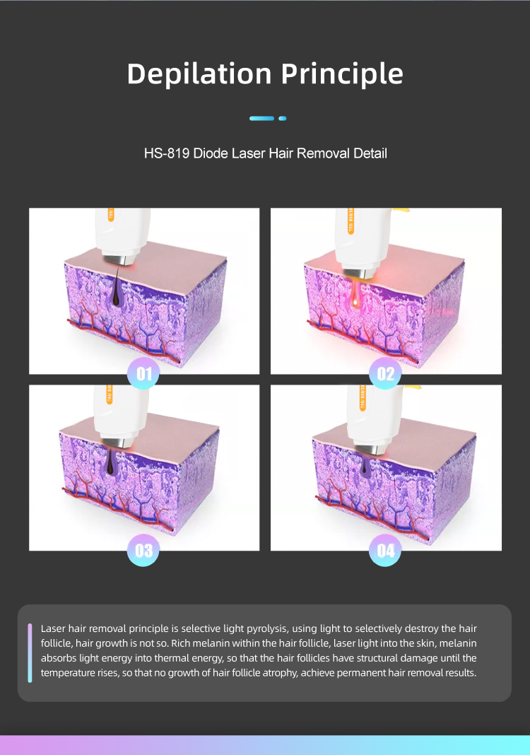 laser hair removal diode machine HS-819插图4