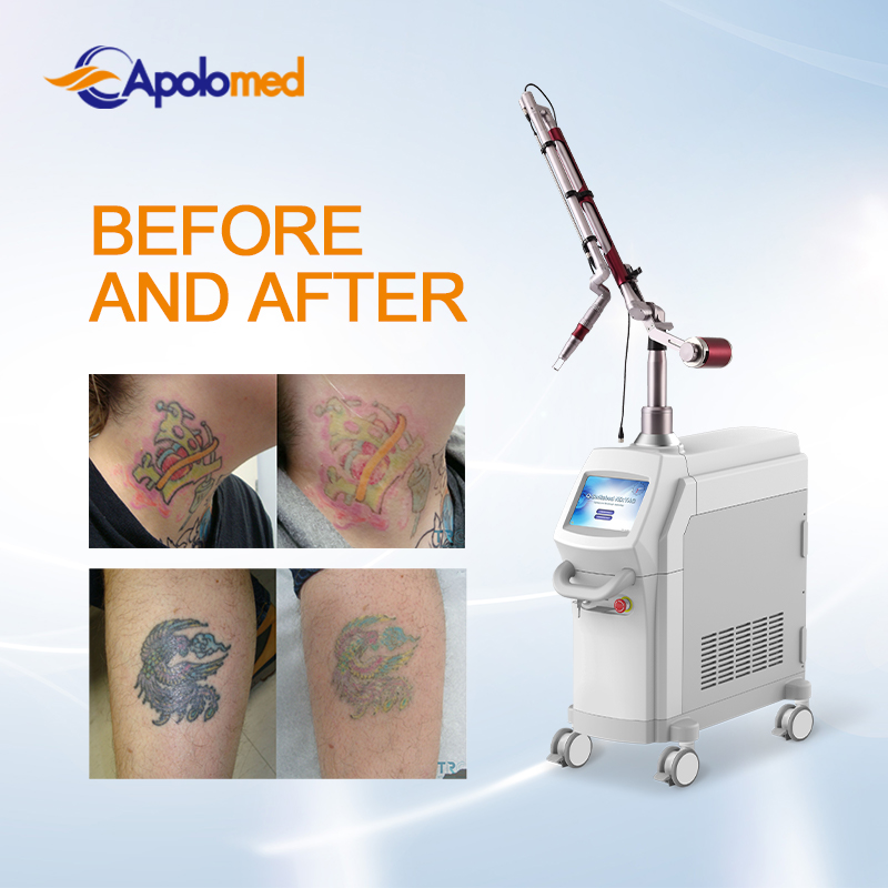 EO q switch nd yag laser tattoo removal HS-290E插图4